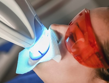 Teeth-Being-Whitened